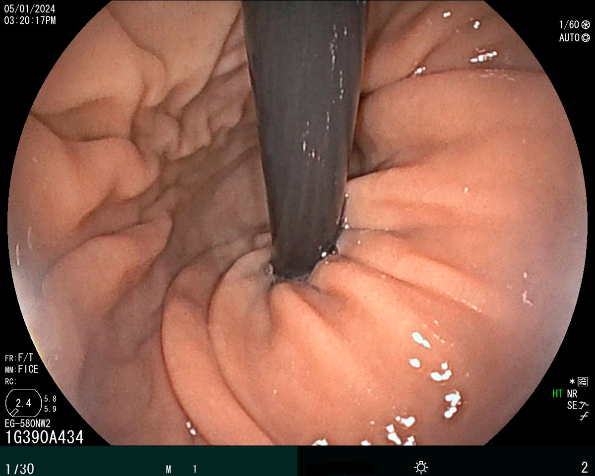 Endoscopia y Cirugía general, Cirugía ortopédica y traumatológica, Cirugía de mínima invasión (laparoscopia, endoscopia y artroscopia)