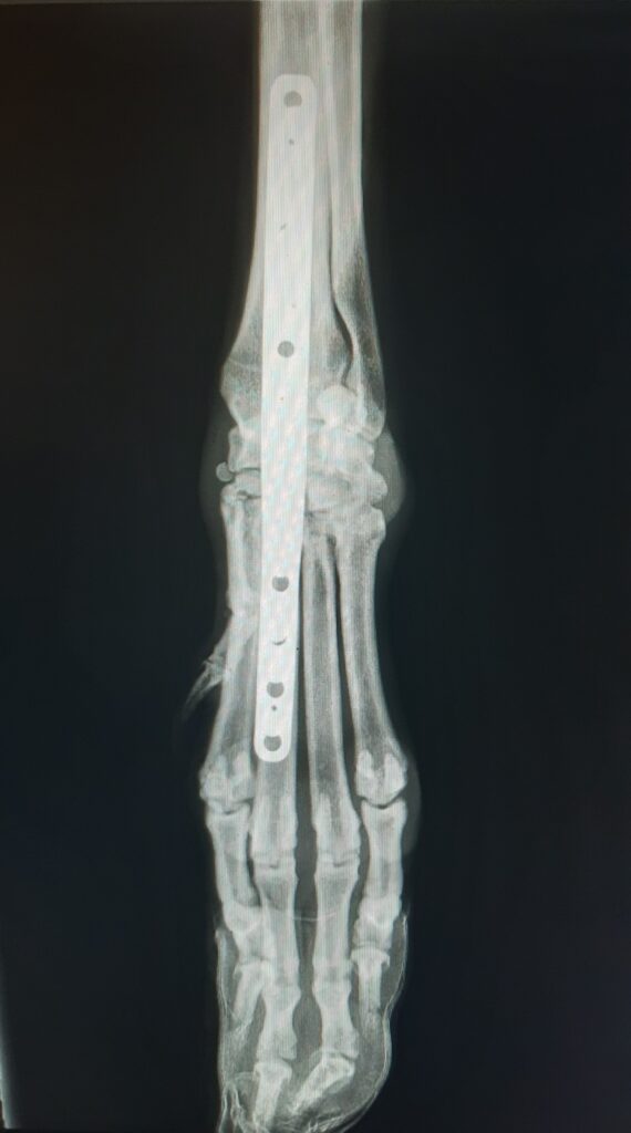 realizamos una artrodesis pancarpal en su pata izquierda. Esta cirugía busca la fusión de los huesos del carpo (muñeca), de modo que esos tendones y ligamentos dañados ya no sean necesarios para un apoyo correcto.